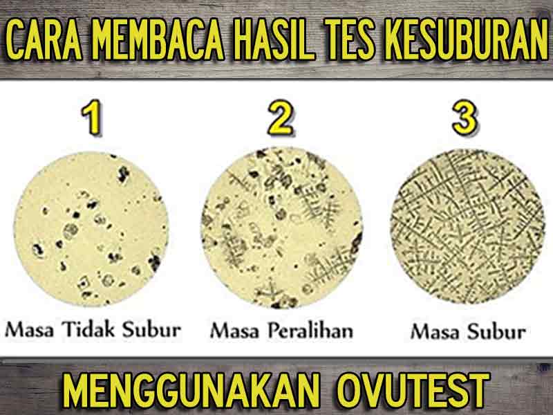 Jual Alat Test Kesuburan Ovutest di Aceh Barat Daya